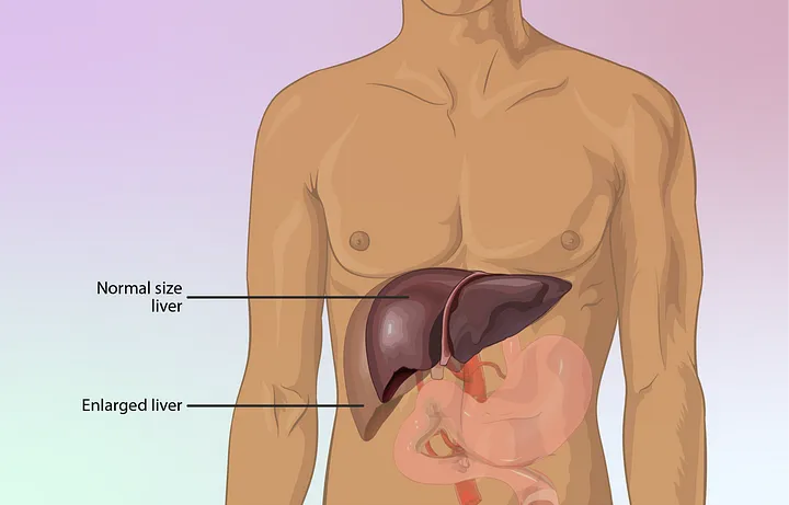 6 Best Foods To Clean Out Your Liver